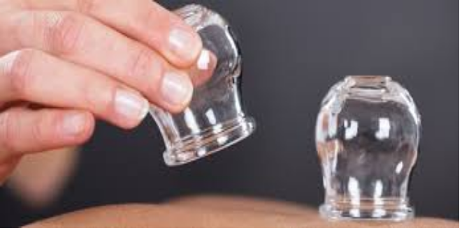 الحجامة: العلاج القديم الذي يعود بقوة – الفوائد، الأنواع، والتطبيقات الحديثة